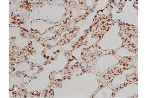 ABIN6267336 at 1/200 staining Rat lung tissue sections by IHC-P. (IGF1R 抗体  (pTyr1346))