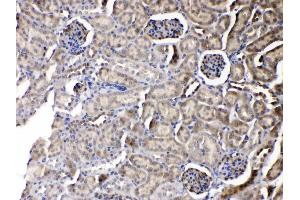 IHC analysis of PNP using anti-PNP antibody . (PNP 抗体  (Middle Region))
