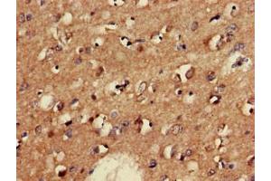 Immunohistochemistry (IHC) image for anti-Glutamate Decarboxylase 2 (Pancreatic Islets and Brain, 65kDa) (GAD2) (AA 1-82) antibody (ABIN7153954)