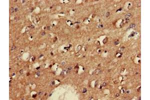 Immunohistochemistry of paraffin-embedded human brain tissue using ABIN7153954 at dilution of 1:100 (GAD65 抗体  (AA 1-82))