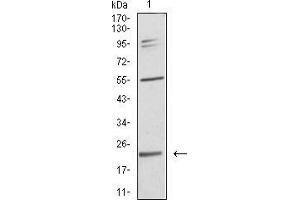 Western blot analysis using IL28A mouse mAb against SK-Br-3 (1) cell lysate. (IL28A 抗体  (AA 1-200))
