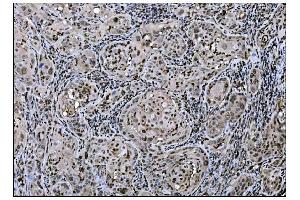 IHC analysis of Fos B/FOSB using anti-Fos B/FOSB antibody (ABIN7599279). (FOSB 抗体  (AA 1-332))