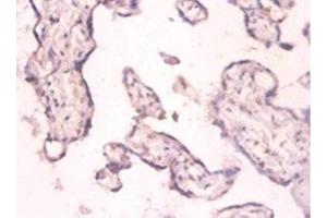 Immunohistochemistry of paraffin-embedded human placenta tissue using ABIN7159368 at dilution of 1:100 (PKMYT1 抗体  (AA 900-1101))