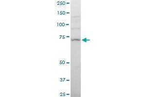 NCSTN polyclonal antibody (A01), Lot # 051214JC01. (Nicastrin 抗体  (AA 16-115))