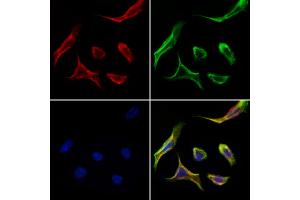 ABIN6259351 and ABIN6275589 staining Hela cells by IF/ICC.