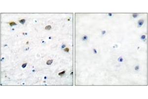Immunohistochemistry analysis of paraffin-embedded human brain tissue, using GABA-RB (Ab-434) Antibody. (GABA-RB (AA 401-450) 抗体)