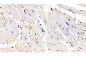 Detection of MAPK6 in Human Cardiac Muscle Tissue using Polyclonal Antibody to Mitogen Activated Protein Kinase 6 (MAPK6) (MAPK6 抗体  (AA 1-316))