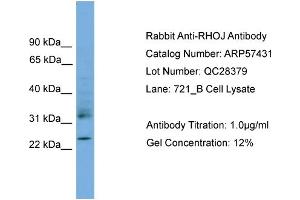 WB Suggested Anti-RHOJ  Antibody Titration: 0. (RHOJ 抗体  (Middle Region))