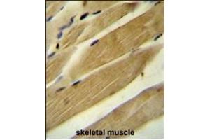 RPH3AL Antibody (C-term) (ABIN654698 and ABIN2844391) immunohistochemistry analysis in formalin fixed and paraffin embedded human skeletal muscle followed by peroxidase conjugation of the secondary antibody and DAB staining. (RPH3AL 抗体  (C-Term))