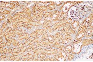 Immunohistochemistry of paraffin-embedded Rat kidney using FGB Polycloanl Antibody at dilution of 1:200