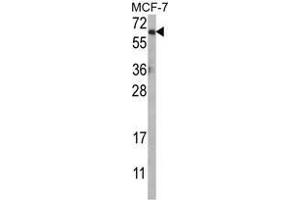Western blot analysis of AKT1 Antibody (N-term) in MCF-7 cell line lysates (35ug/lane). (AKT1 抗体  (N-Term))