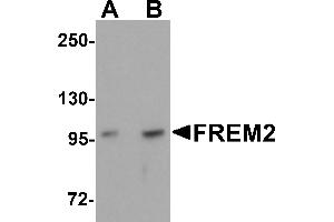 Western Blotting (WB) image for anti-Fras1 Related Extracellular Matrix Protein 2 (FREM2) (Middle Region) antibody (ABIN1030933) (FREM2 抗体  (Middle Region))