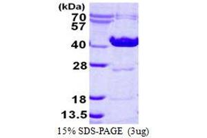 Ornithine Carbamoyltransferase (OTC) (AA 33-354) protein (His tag)