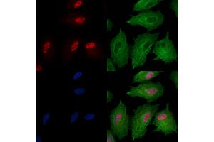 Phospho-SIRT6 (Ser10) Antibody staining A549 cells(heat shock treatment) by IF/ICC. (SIRT6 抗体  (pSer10))