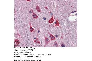 Immunohistochemistry with Human Brain, cortex tissue at an antibody concentration of 5. (T-Box 5 抗体  (N-Term))