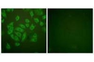 Immunofluorescence analysis of A549 cells, using Stefin A antibody. (CSTA 抗体  (C-Term))