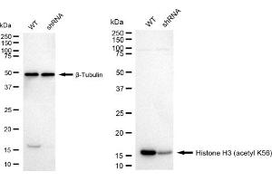 Western blotting analysis using Histone H3 (acetyl K56) antibody (ABIN7798972). (Recombinant Histone 3 抗体  (H3K56ac))