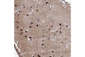 Immunohistochemical staining of human cerebral cortex with CKAP5 polyclonal antibody  shows strong cytoplasmic positivity in neuronal cells. (CKAP5 抗体)
