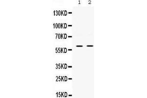 Western blot analysis of SKAP55 expression in PANC whole cell lysates (lane 1) and JURKAT whole cell lysates (lane 2). (SKAP1 抗体  (Middle Region))