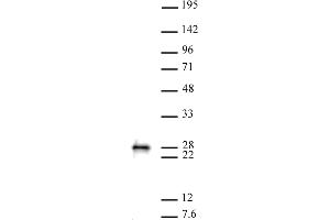 MGMT antibody (pAb) tested by Western blot. (MGMT 抗体  (C-Term))
