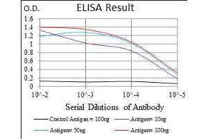Black line: Control Antigen (100 ng), Purple line: Antigen(10 ng), Blue line: Antigen (50 ng), Red line: Antigen (100 ng), (Calmegin 抗体  (AA 249-405))