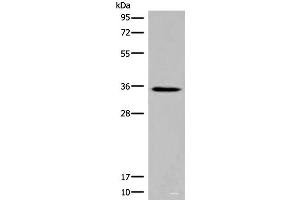Western blot analysis of Rat kidney tissue lysate using ITM2B Polyclonal Antibody at dilution of 1:500 (ITM2B 抗体)