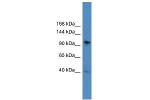 WB Suggested Anti-BCL11B Antibody Titration: 0. (BCL11B 抗体  (C-Term))