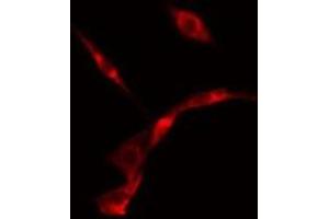 ABIN6275653 staining  NIH-3T3 cells by IF/ICC. (USP19 抗体  (Internal Region))