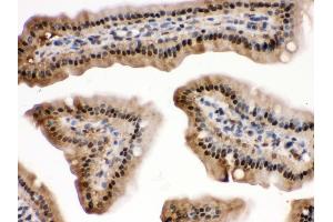 Immunohistochemistry (Paraffin-embedded Sections) (IHC (p)) image for anti-Mitogen-Activated Protein Kinase 13 (MAPK13) (AA 332-365), (C-Term) antibody (ABIN3043610) (MAPK13 抗体  (C-Term))