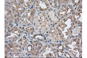 Immunohistochemical staining of paraffin-embedded Human prostate tissue using anti-BSG mouse monoclonal antibody. (CD147 抗体)