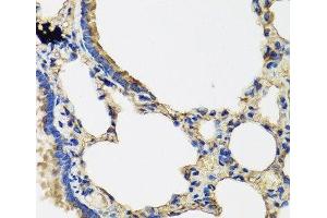 Immunohistochemistry of paraffin-embedded Rat lung using IL36G Polyclonal Antibody at dilution of 1:100 (40x lens). (IL1F9 抗体)