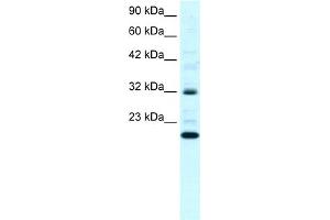 WB Suggested Anti-ARHGDIG Antibody Titration:  0. (ARHGDIG 抗体  (N-Term))