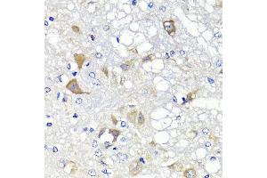 Immunohistochemistry of paraffin-embedded rat brain using PSPH antibody at dilution of 1:100 (x40 lens). (PSPH 抗体)