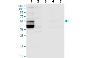 Western blot analysis of Lane 1: RT-4, Lane 2: U-251 MG, Lane 3: Human Plasma, Lane 4: Liver, Lane 5: Tonsil with SLC38A7 polyclonal antibody  at 1:250-1:500 dilution.