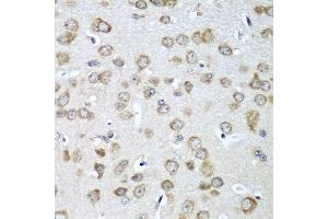 Immunohistochemistry of paraffin-embedded mouse brain using EIF1AX antibody.