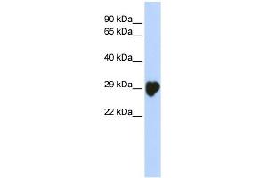 WB Suggested Anti-CA1 Antibody Titration: 0. (CA1 抗体  (N-Term))