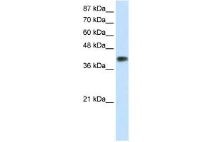 WB Suggested Anti-DLX3 Antibody Titration:  1. (DLX3 抗体  (C-Term))