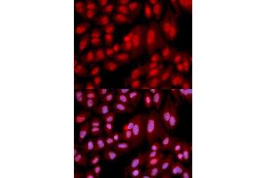 Immunofluorescence analysis of U2OS cell using PPP2R2A antibody. (PPP2R2A 抗体)