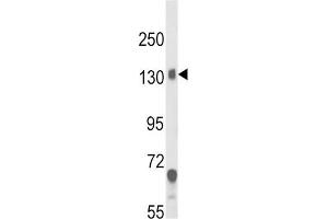Western Blotting (WB) image for anti-Calcium Channel, Voltage-Dependent, alpha 2/delta Subunit 1 (CACNA2D1) antibody (ABIN3003877)