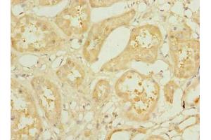 Immunohistochemistry of paraffin-embedded human kidney tissue using ABIN7157306 at dilution of 1:100 (KLHDC5 抗体  (AA 1-410))