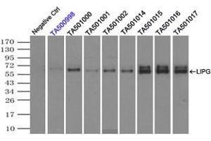 Image no. 5 for anti-Lipase, Endothelial (LIPG) antibody (ABIN1499174) (LIPG 抗体)