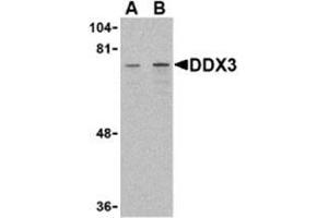 Western blot analysis of DDX3 in HepG2 cell lysate with AP30283PU-N DDX3 antibody at (A) 1 and (B) 2 μg/ml. (DDX3X 抗体  (Intermediate Domain))