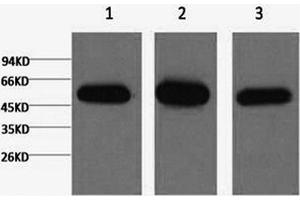 Western Blotting (WB) image for anti-Tubulin, beta 1 (TUBB1) antibody (ABIN5956137)