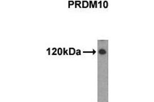Western Blotting (WB) image for anti-PR Domain Containing 10 (PRDM10) (N-Term) antibody (ABIN356377) (PRDM10 抗体  (N-Term))