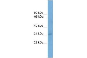 Human 293T; WB Suggested Anti-TAPBP Antibody Titration: 0. (TAPBP 抗体  (N-Term))