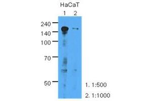 The extracts of HaCaT (35 ug) were resolved by SDS-PAGE, transferred to PVDF membrane and probed with anti-human EGFR (1:500 or 1000). (EGFR 抗体  (AA 424-605))