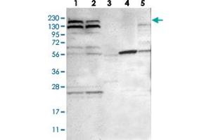 Western blot analysis of Lane 1: RT-4, Lane 2: U-251 MG, Lane 3: Human Plasma, Lane 4: Liver, Lane 5: Tonsil with PARP14 polyclonal antibody  at 1:250-1:500 dilution. (PARP14 抗体)