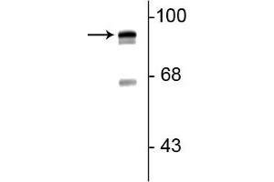 Western blot of rat lung lysate showing specific immunolabeling of the ~93 kDa periostin protein doublet. (Periostin 抗体  (C-Term))