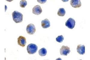 Immunohistochemistry (IHC) image for anti-CASP8 and FADD-Like Apoptosis Regulator (CFLAR) (N-Term) antibody (ABIN1031381) (FLIP 抗体  (N-Term))