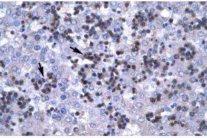 Human Liver; RBPSUH antibody - C-terminal region in Human Liver cells using Immunohistochemistry (RBPJ 抗体  (C-Term))